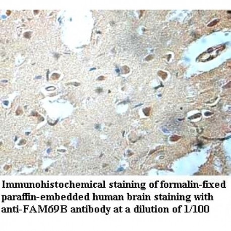 FAM69B Antibody