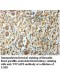 TNFAIP6 Antibody