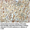 TNFAIP6 Antibody