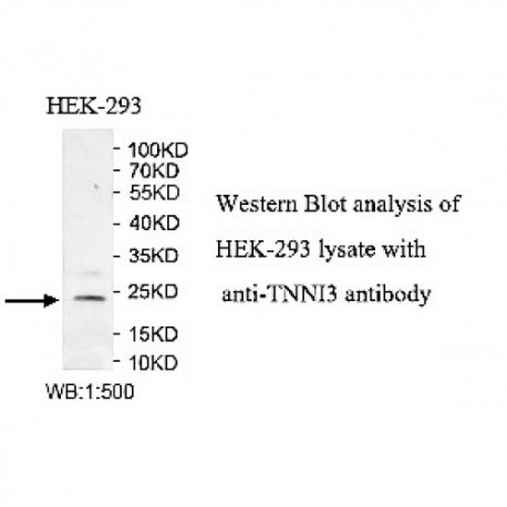 TNNI3 Antibody