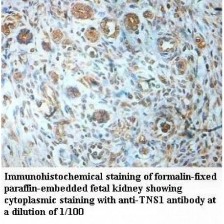 TNS1 Antibody