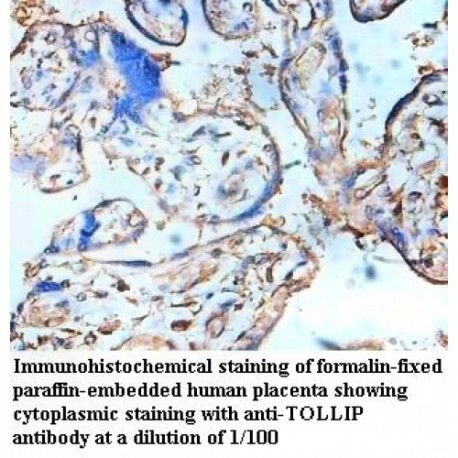 TOLLIP Antibody