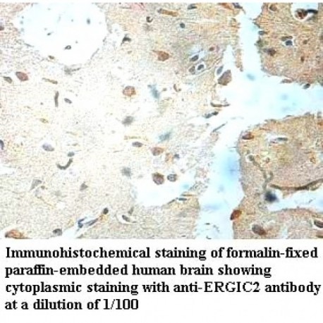 ERGIC2 Antibody