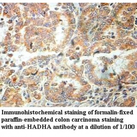 HADHA Antibody