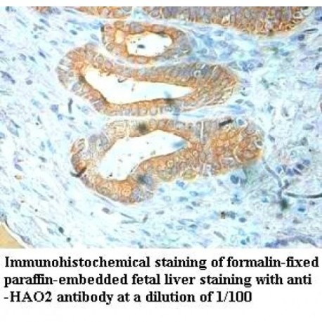 HAO2 Antibody