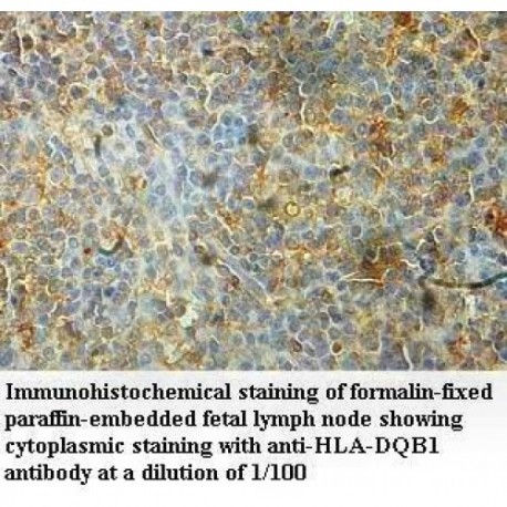 HLA-DQB1 Antibody