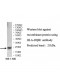 HLA-DQB1 Antibody