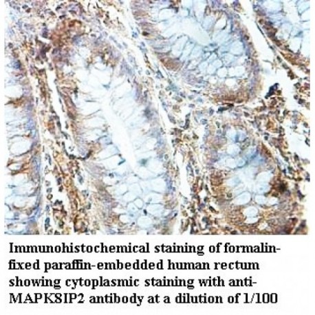 MAPK8IP2 Antibody