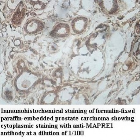 MAPRE1 Antibody