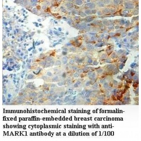 MARK1 Antibody