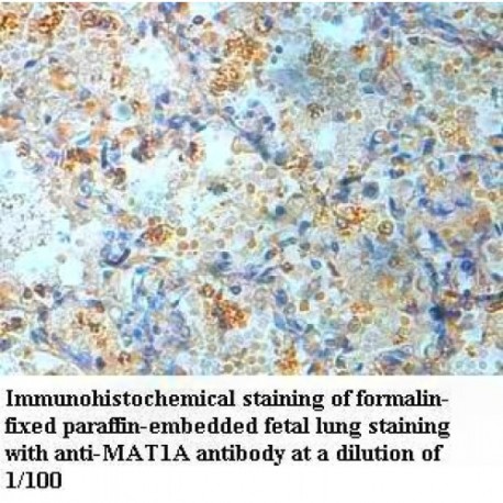 MAT1A Antibody