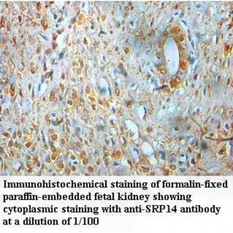 SRP14 Antibody