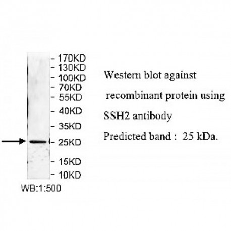 SSH2 Antibody