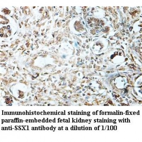 SSX1 Antibody