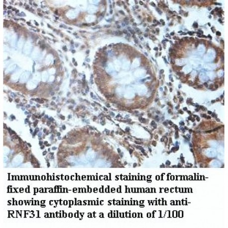 RNF31 Antibody