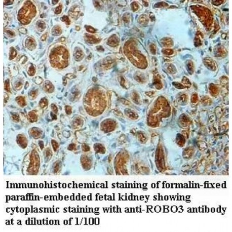 ROBO3 Antibody