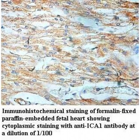 ICA1 Antibody