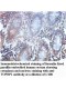 TOPBP1 Antibody