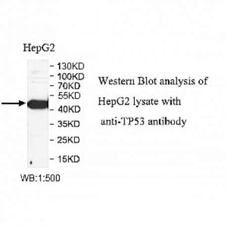 TP53 Antibody