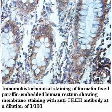 TREH Antibody