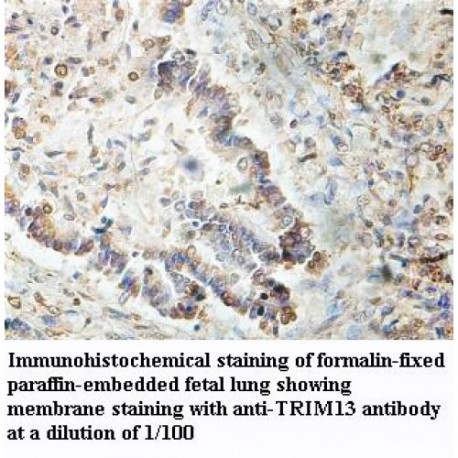 TRIM13 Antibody