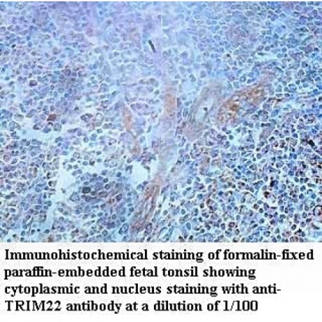 TRIM22 Antibody