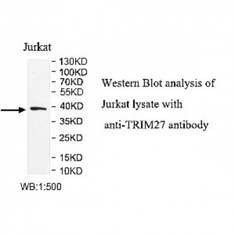 TRIM27 Antibody