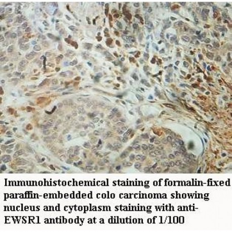 EWSR1 Antibody