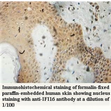 IFI16 Antibody