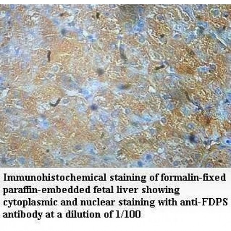 FDPS Antibody