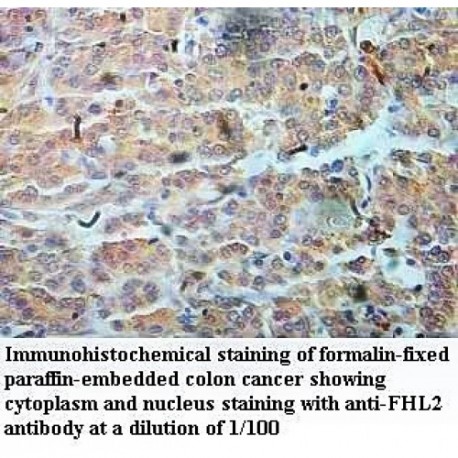 FHL2 Antibody