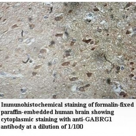 GABRG1 Antibody