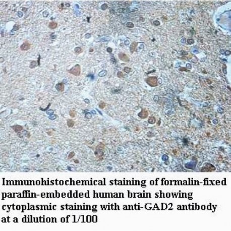 GAD2 Antibody