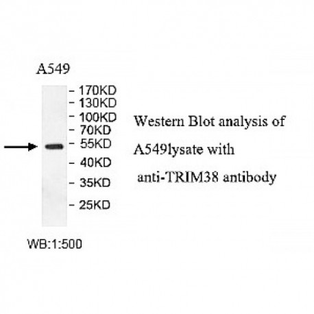 TRIM38 Antibody