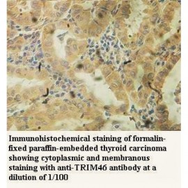 TRIM46 Antibody