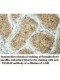 TRIM49 Antibody