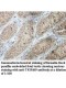 TRIM69 Antibody