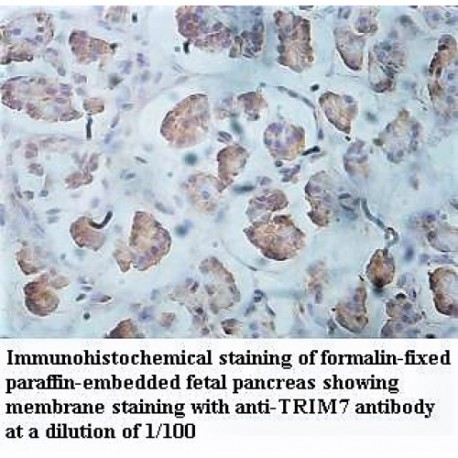 TRIM7 Antibody