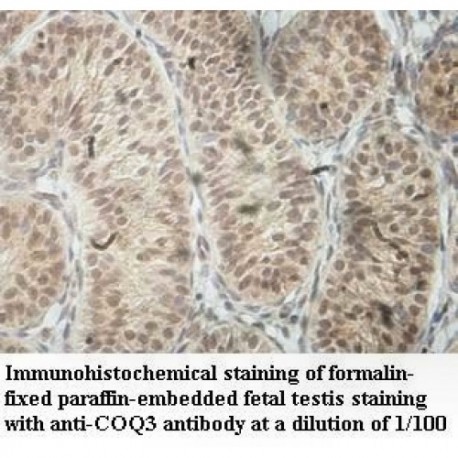 GAD1 Antibody