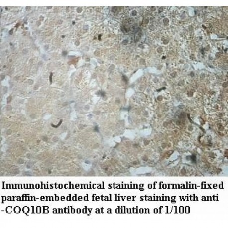 COQ10B Antibody