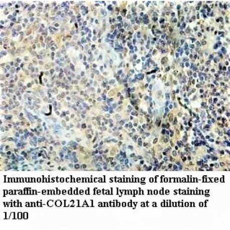 COL21A1 Antibody