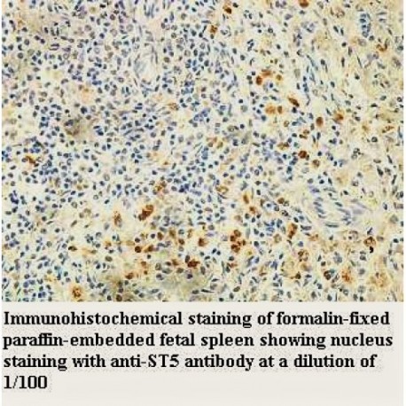 ST5 Antibody