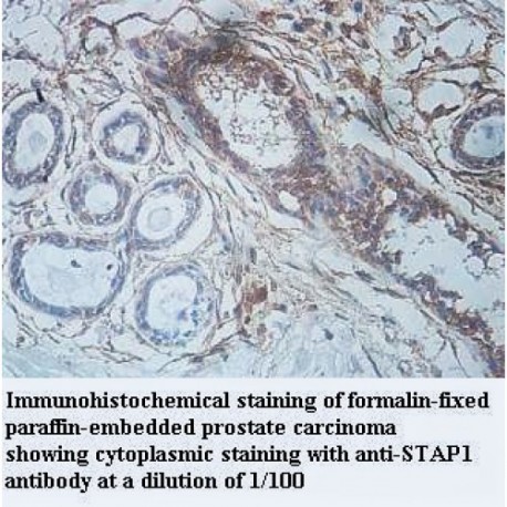 STAP1 Antibody