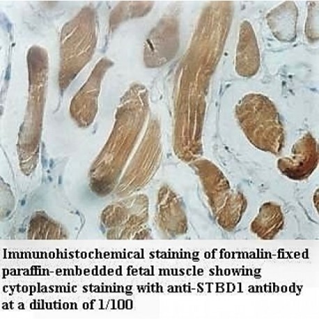 STBD1 Antibody