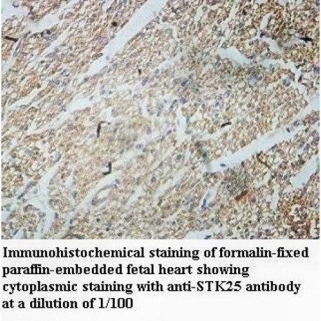 STK25 Antibody