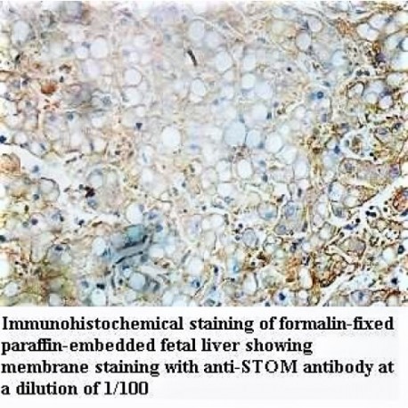 STOM Antibody