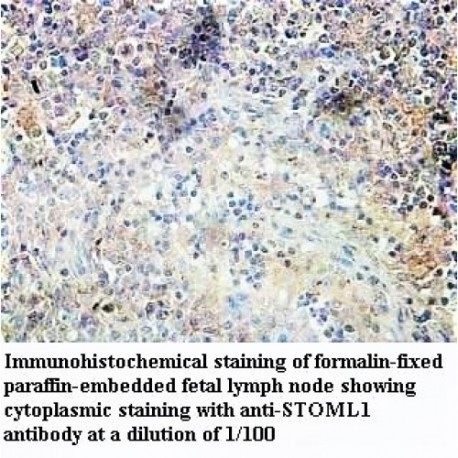 STOML1 Antibody