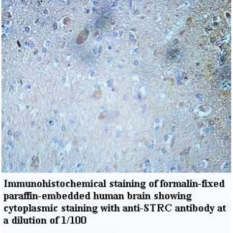 STRC Antibody