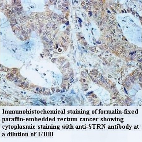 STRN Antibody