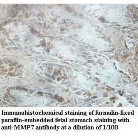 MMP7 Antibody